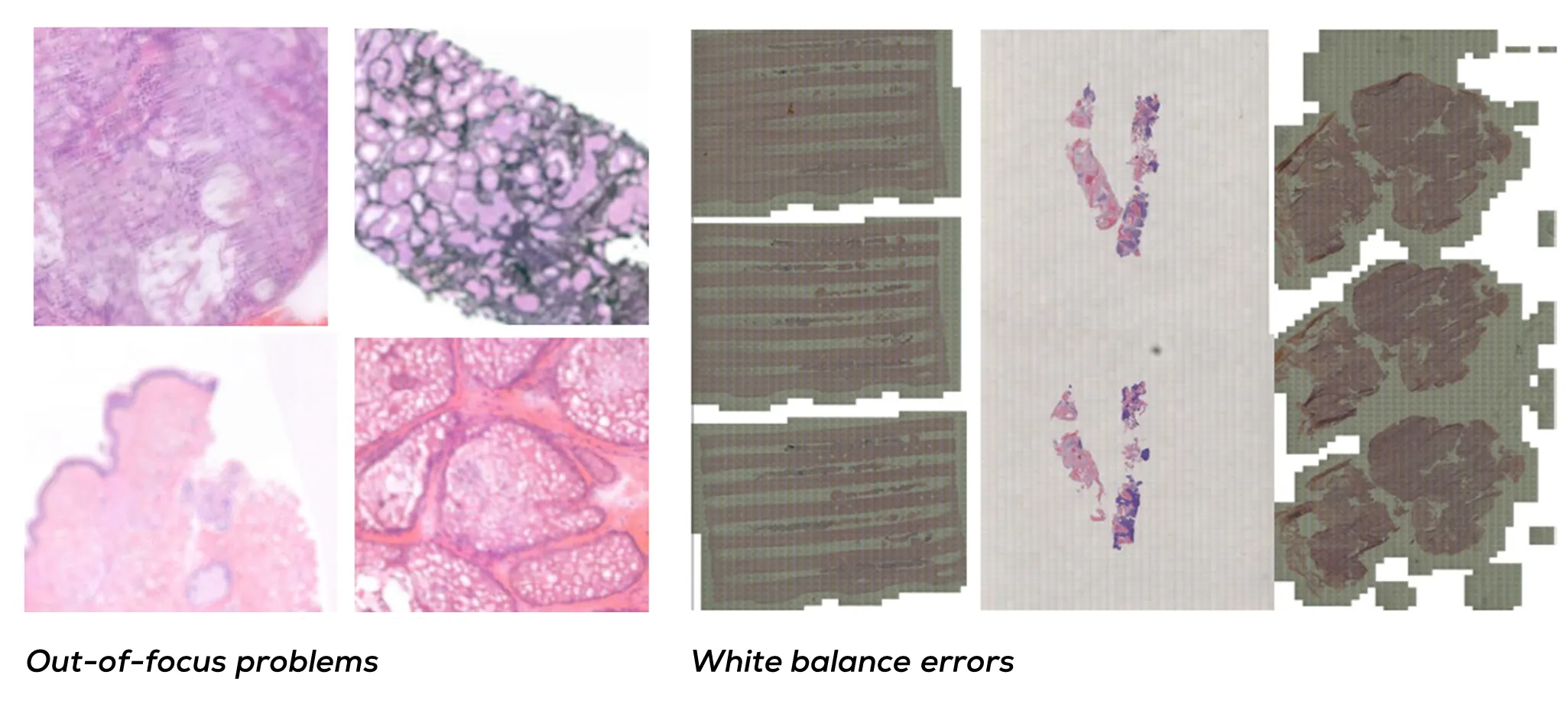 Digital histology slide artifact examples. Left: 4 images flagged due to focus problems. Right: 3 slides that appear darker than expected, in different tones of gray, due to white balance errors.