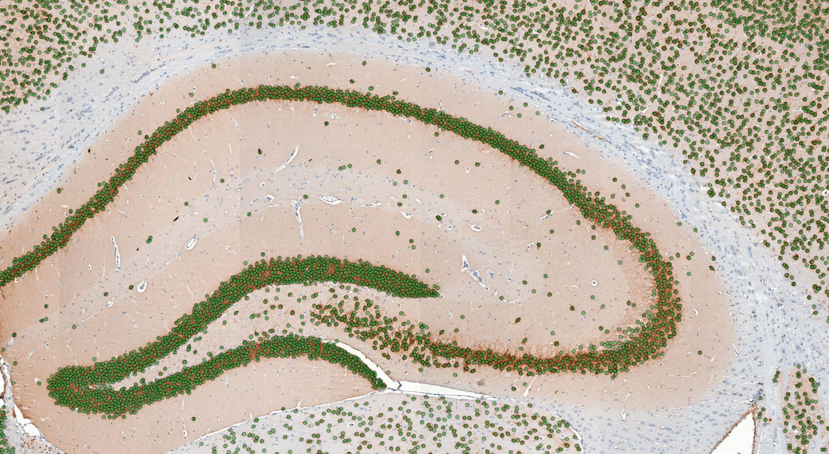 AI read-out of brain tissue
