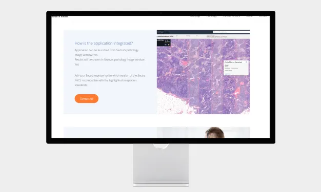 Aiosyn’s AI-powered quality control for digital pathology slides is now available in Sectra Amplifier Marketplace