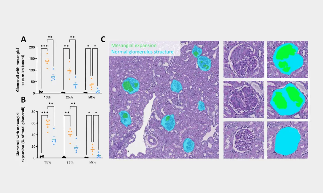 Aiosyn’s NephroPath quantitative image analysis featured in Physiogenex's research posters at ASN Kidney Week