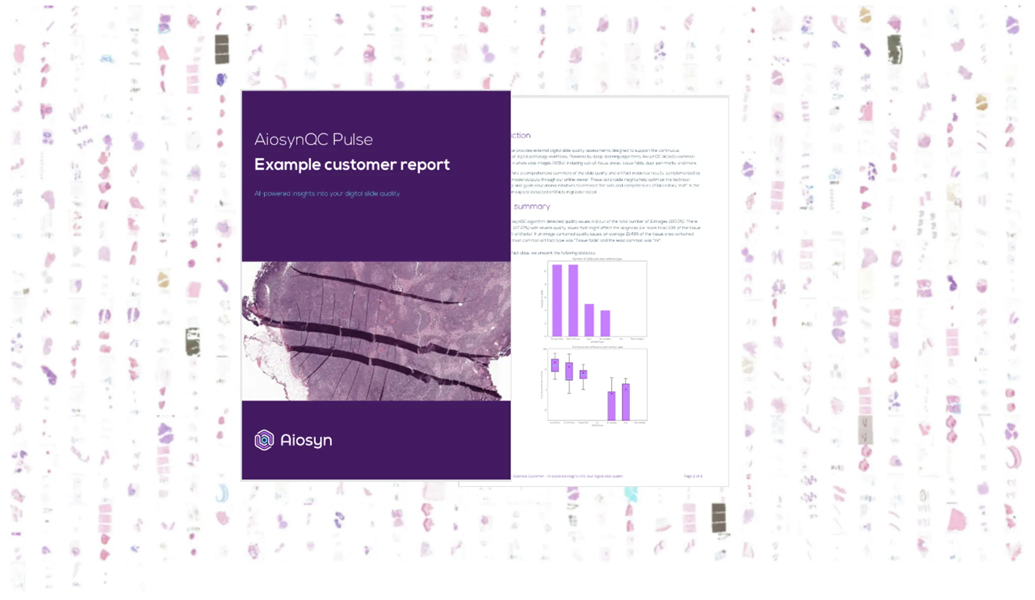 Aiosyn launches AiosynQC Pulse for external digital slide quality assessments, providing pathology labs with insights for slide quality improvement