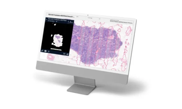 Aiosyn launches AI-powered automated quality control to improve the digital pathology workflow