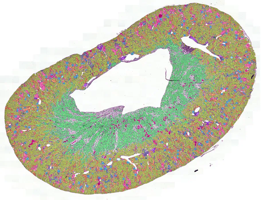 AI read-out of kidney tissue