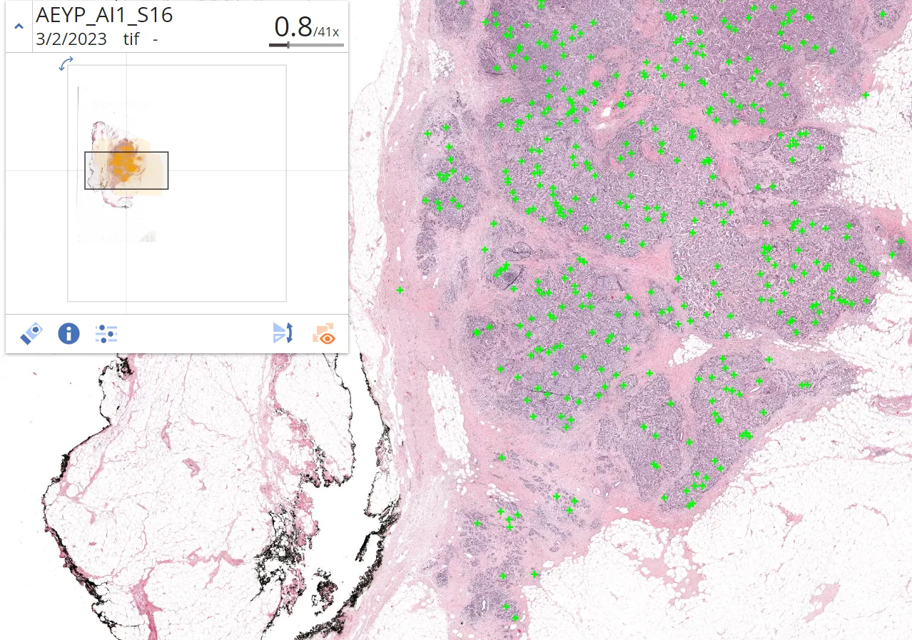 A breast section at low magnification in a pathology viewer, with every mitotic figure detected by Aiosyn Mitosis Breast marked in green across the whole slide.